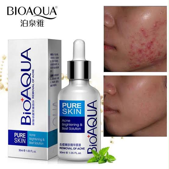 Bioaqua Pure Skin Acne Removal Serum — view 1