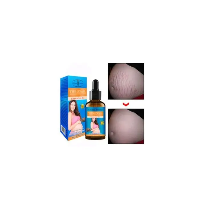 Aichun Beauty Stretch Mark Oil